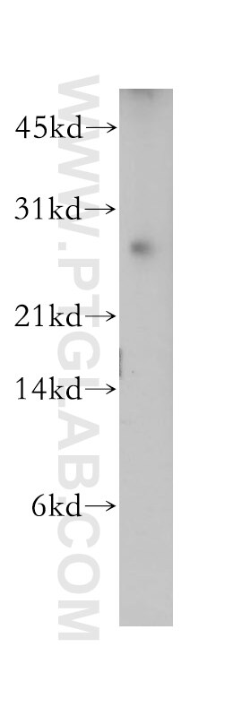 Western Blot (WB) analysis of human placenta tissue using DIRAS1 Polyclonal antibody (12634-1-AP)