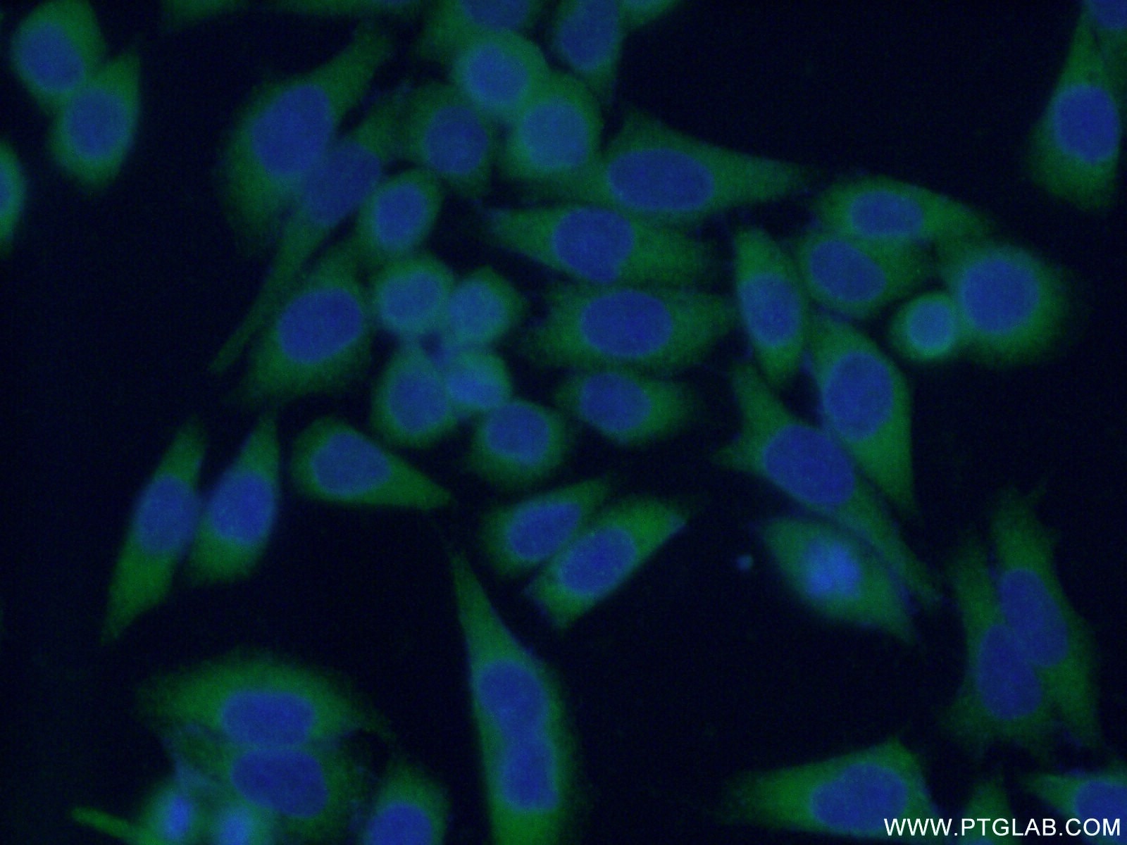 Immunofluorescence (IF) / fluorescent staining of HeLa cells using DIRAS2 Polyclonal antibody (15557-1-AP)