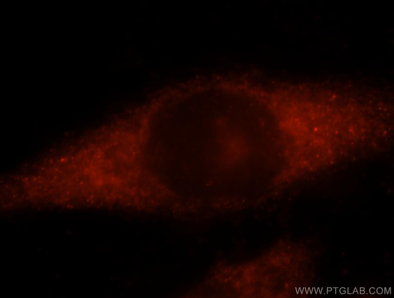 Immunofluorescence (IF) / fluorescent staining of HeLa cells using DIRAS2 Polyclonal antibody (15557-1-AP)