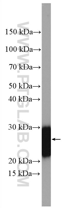 Western Blot (WB) analysis of rat brain tissue using DIRAS2 Polyclonal antibody (15557-1-AP)