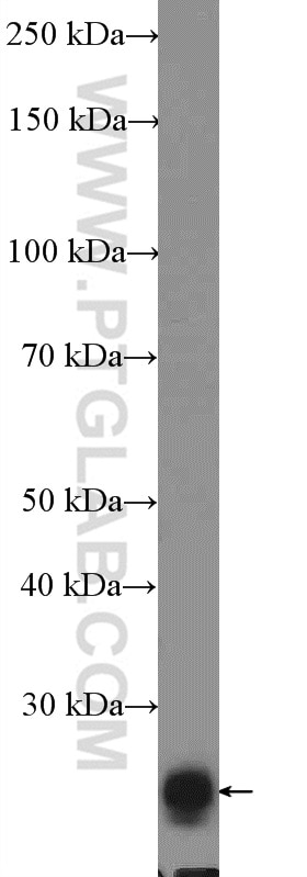 Western Blot (WB) analysis of mouse brain tissue using DIRAS2 Polyclonal antibody (15557-1-AP)