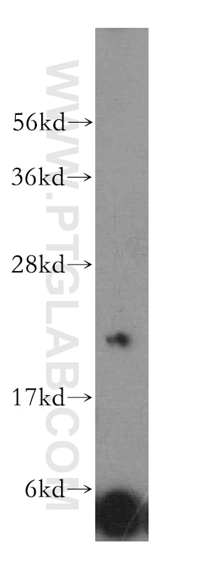 Western Blot (WB) analysis of HeLa cells using DIRAS2 Polyclonal antibody (15557-1-AP)