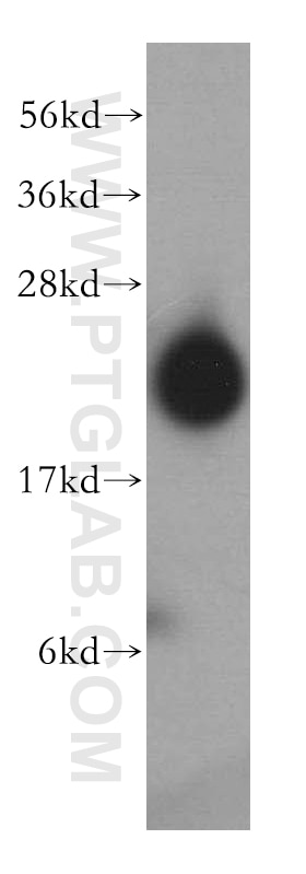 Western Blot (WB) analysis of human brain tissue using DIRAS2 Polyclonal antibody (15557-1-AP)