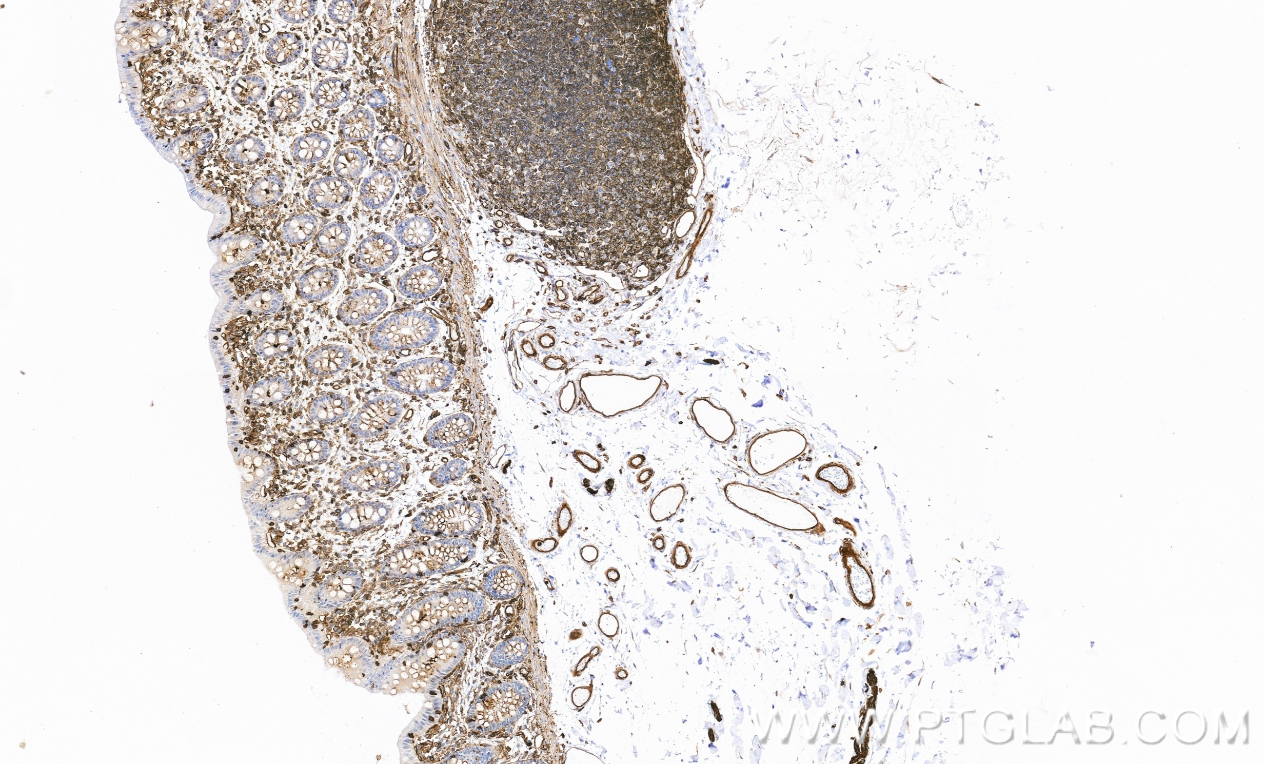 Immunohistochemistry (IHC) staining of human colon tissue using DIRAS2 Recombinant monoclonal antibody (86460-1-RR)