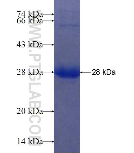 DIRAS2 fusion protein Ag7814 SDS-PAGE