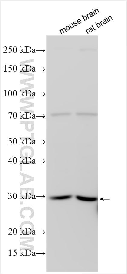 Western Blot (WB) analysis of various lysates using ARHI Polyclonal antibody (10811-2-AP)