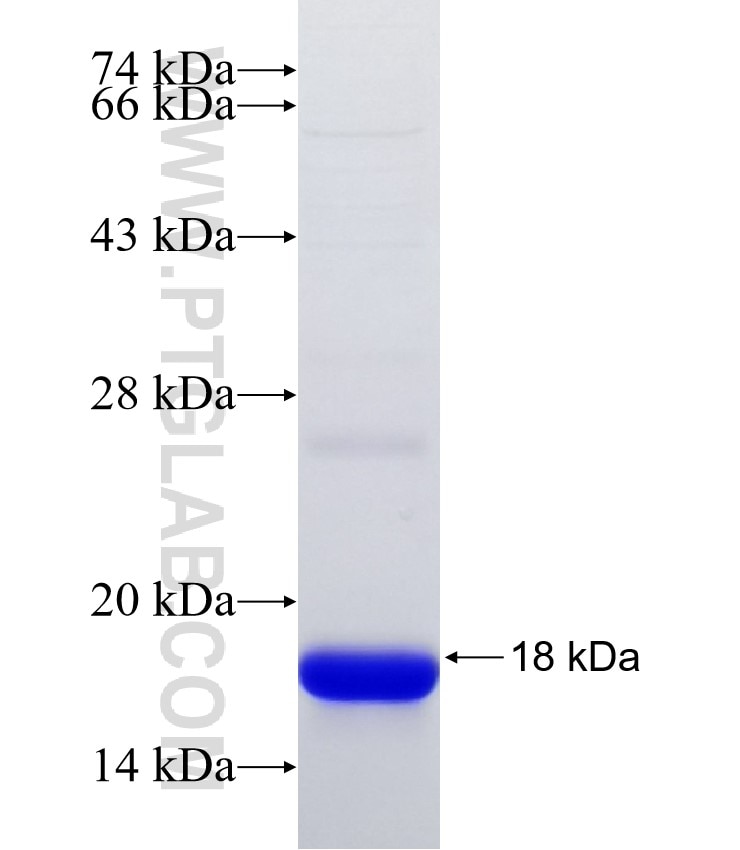 DIRAS3 fusion protein Ag32476 SDS-PAGE DIRAS3 fusion protein Ag32476 SDS-PAGE