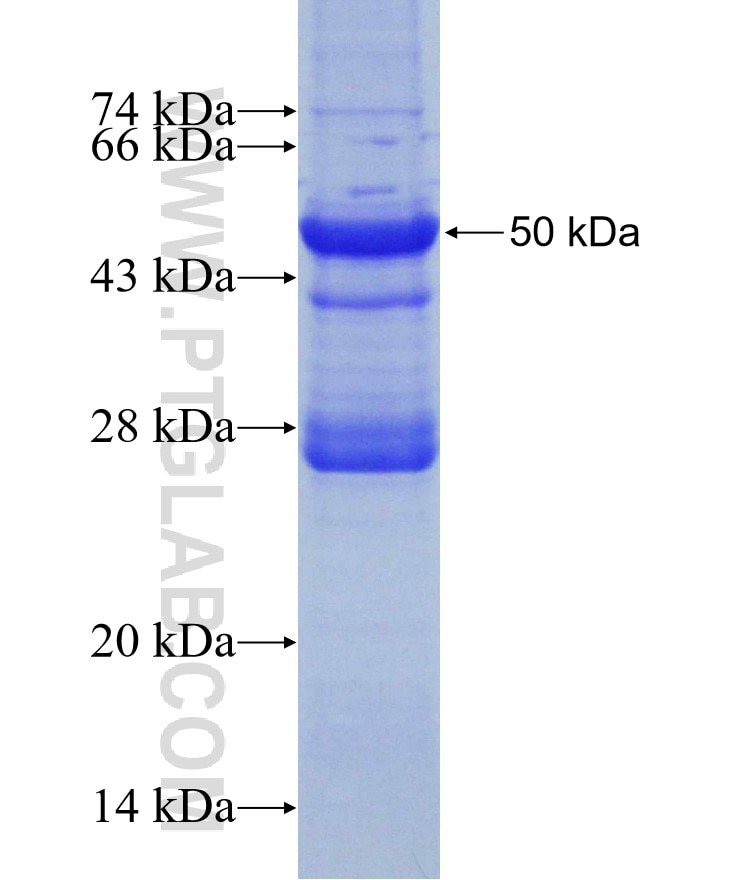 DIRAS3 fusion protein Ag1123 SDS-PAGE