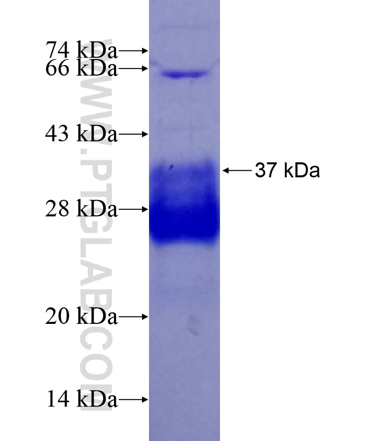 DIRC1 fusion protein Ag18534 SDS-PAGE