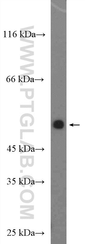 WB analysis of MCF-7 using 26750-1-AP