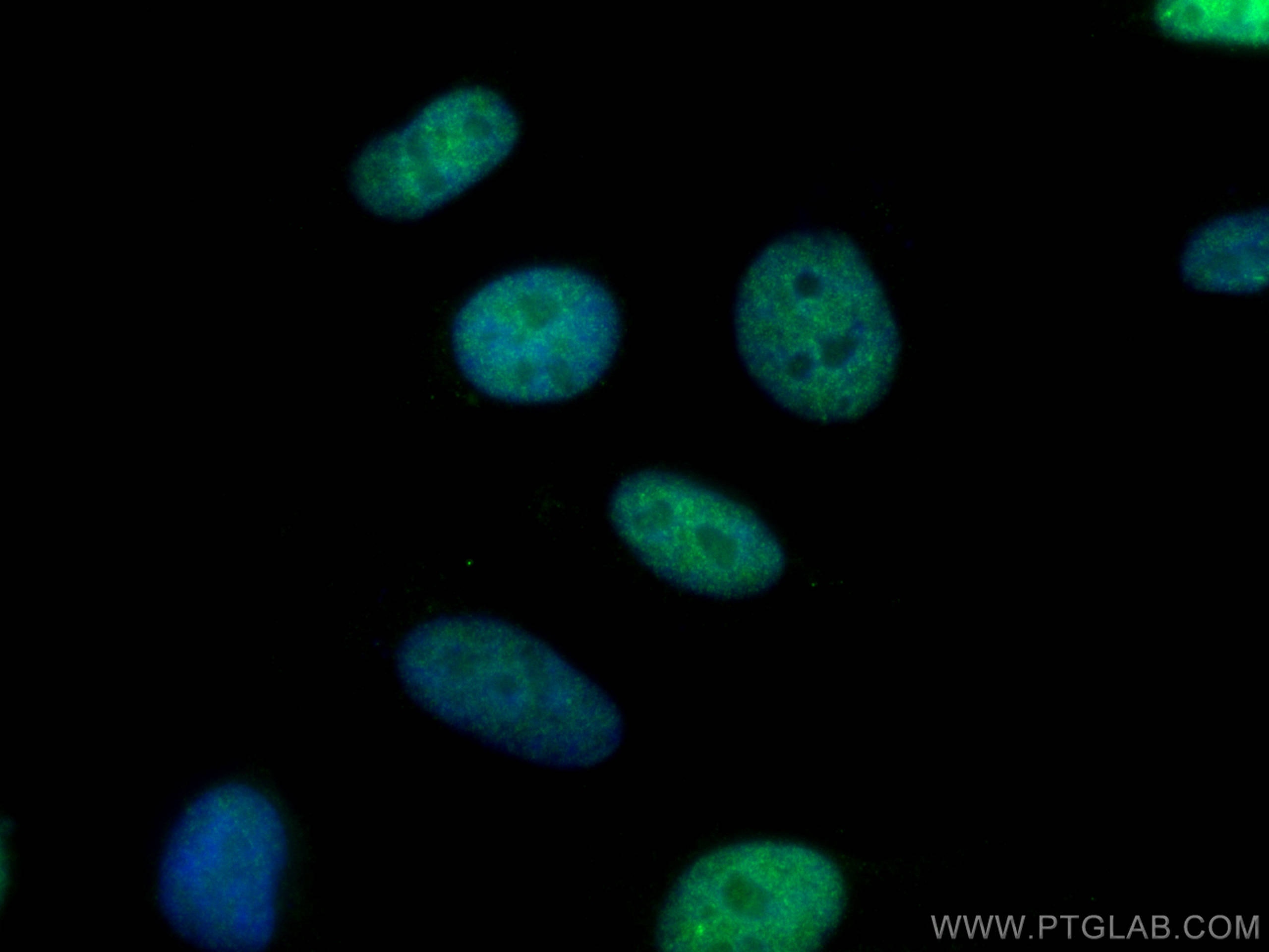Immunofluorescence (IF) / fluorescent staining of HeLa cells using DIS3 Polyclonal antibody (14689-1-AP)