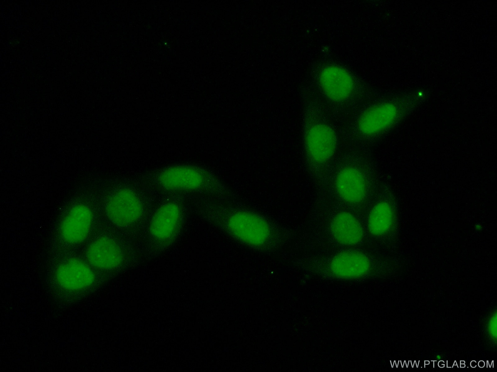 Immunofluorescence (IF) / fluorescent staining of HeLa cells using DIS3 Polyclonal antibody (14689-1-AP)
