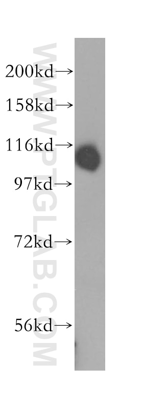 Western Blot (WB) analysis of mouse testis tissue using DIS3 Polyclonal antibody (14689-1-AP)