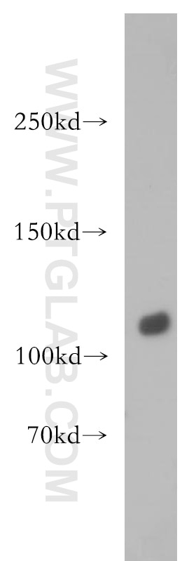 Western Blot (WB) analysis of mouse ovary tissue using DIS3 Polyclonal antibody (14689-1-AP)