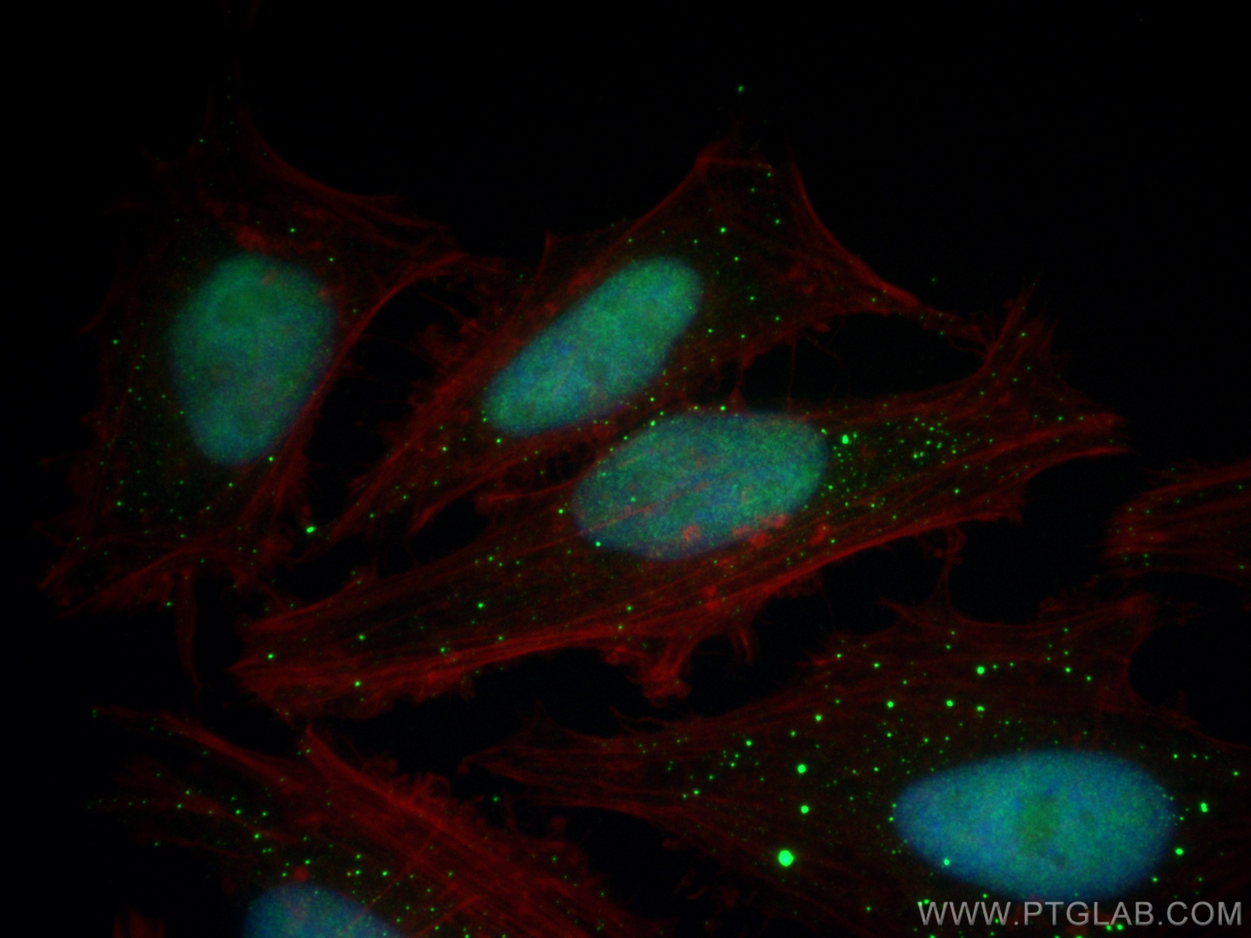Immunofluorescence (IF) / fluorescent staining of HeLa cells using DIS3 Polyclonal antibody (29664-1-AP)