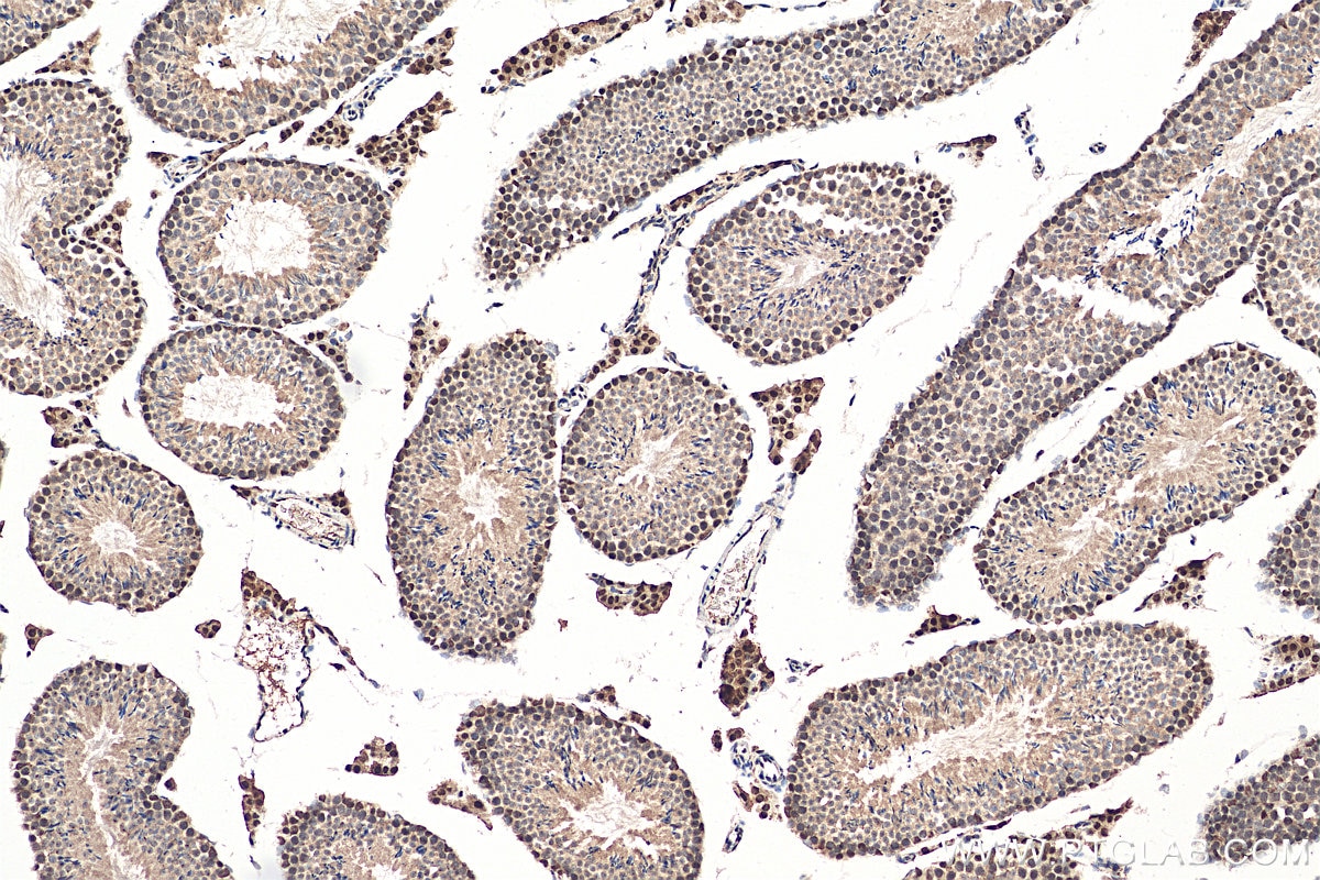 Immunohistochemistry (IHC) staining of mouse testis tissue using DIS3 Polyclonal antibody (29664-1-AP)