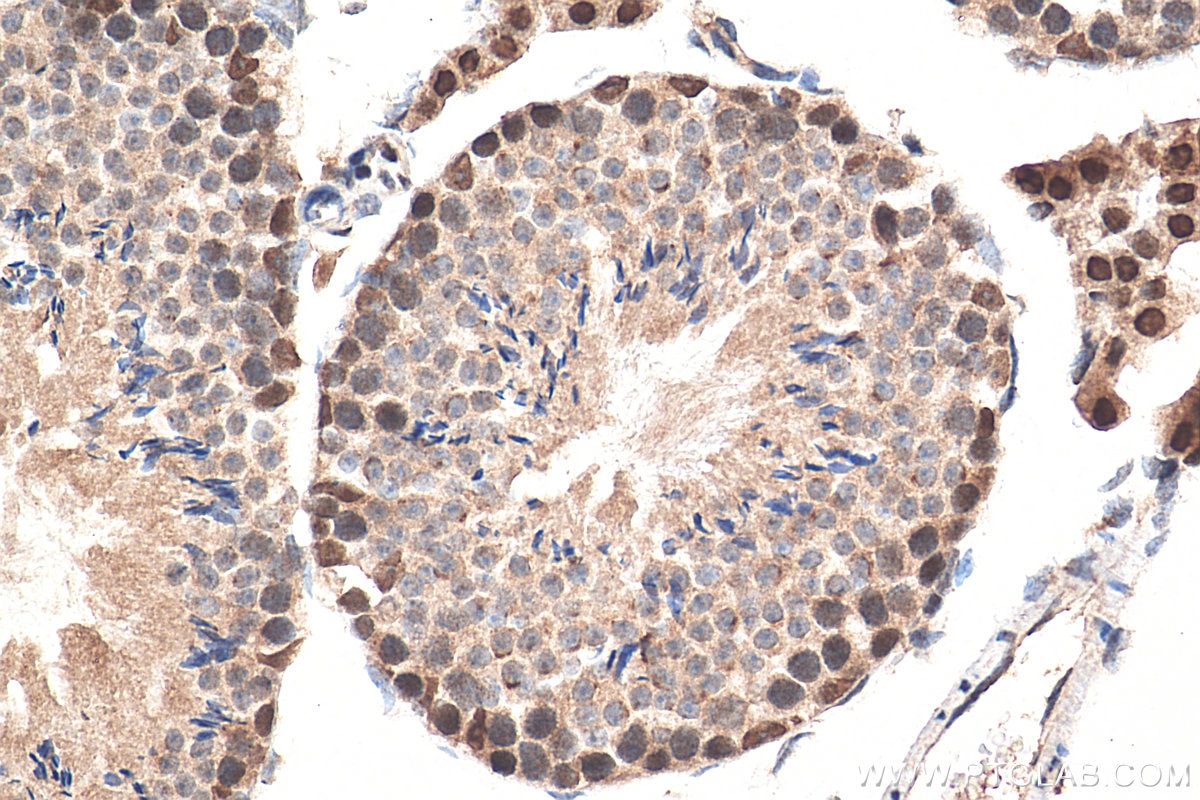 Immunohistochemistry (IHC) staining of mouse testis tissue using DIS3 Polyclonal antibody (29664-1-AP)