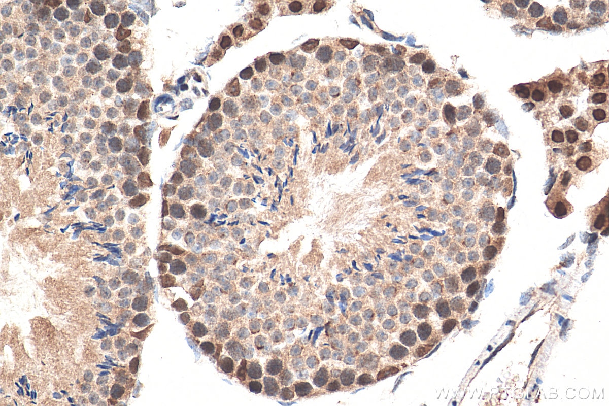 IHC staining of mouse testis using 29664-1-AP