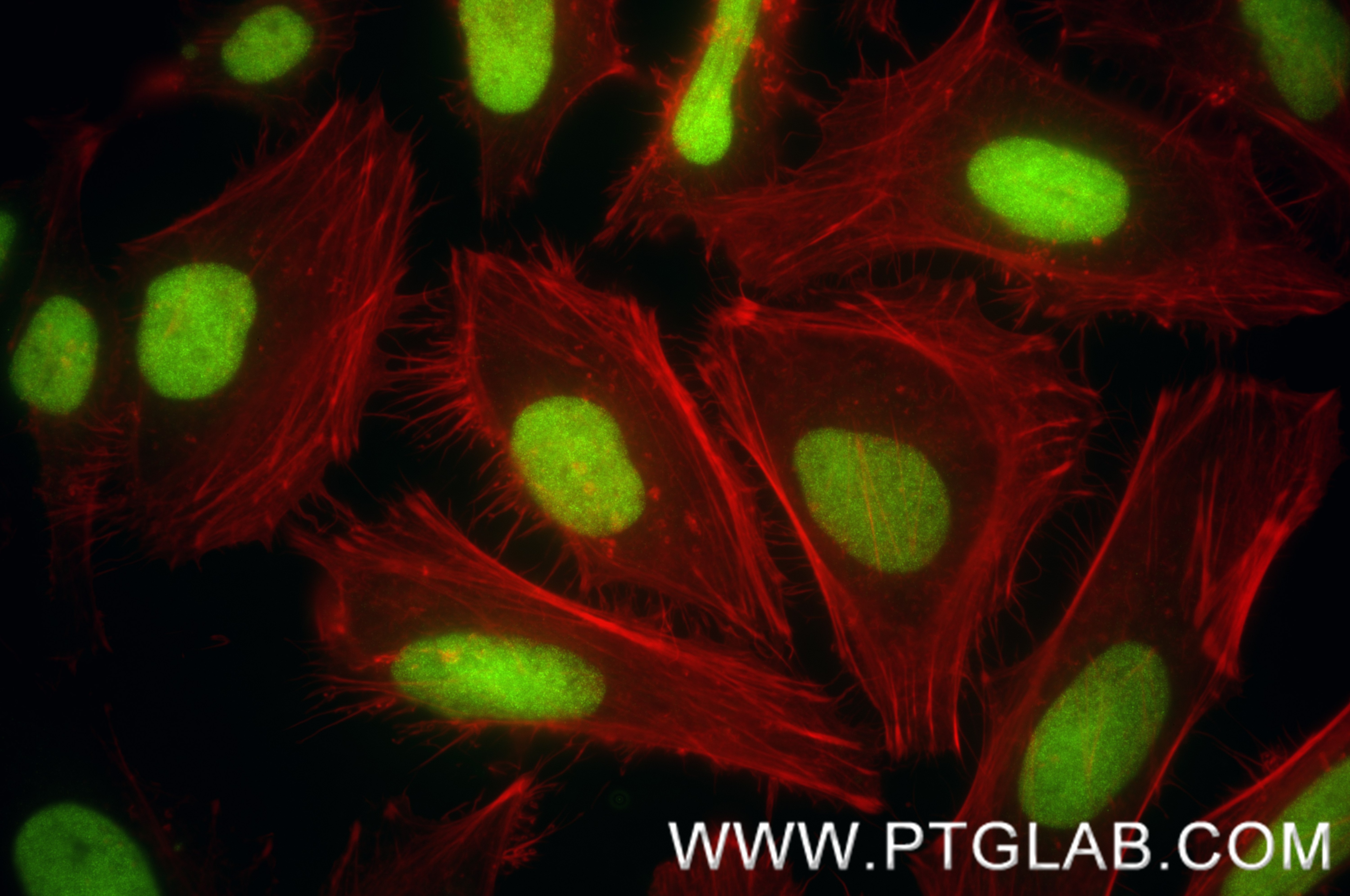 Immunofluorescent analysis of (4% PFA) fixed HeLa cells using DIS3 antibody (85705-2-RR, Clone: 242934G8 ) at dilution of 1:200 and CoraLite®488-Conjugated Goat Anti-Rabbit IgG(H+L) (SA00013-2), CL594-Phalloidin (red). Immunofluorescence (IF) / fluorescent staining of HeLa cells using DIS3 Recombinant antibody (85705-2-RR)