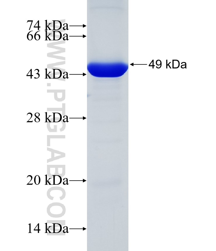 DIS3 fusion protein Ag31725 SDS-PAGE