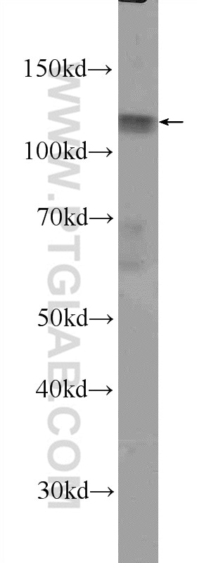 Western Blot (WB) analysis of K-562 cells using DIS3L Polyclonal antibody (25746-1-AP)