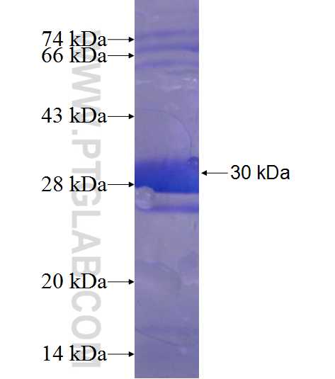 DIS3L fusion protein Ag22689 SDS-PAGE