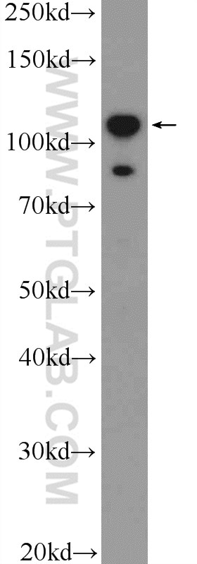 Western Blot (WB) analysis of HepG2 cells using DIS3L2 Polyclonal antibody (25792-1-AP)