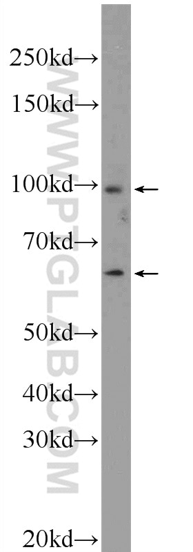 Western Blot (WB) analysis of mouse embryo tissue using DIS3L2 Polyclonal antibody (25792-1-AP)