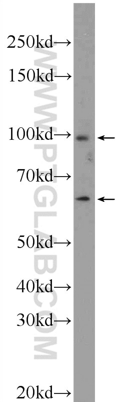 WB analysis of mouse embryo using 25792-1-AP