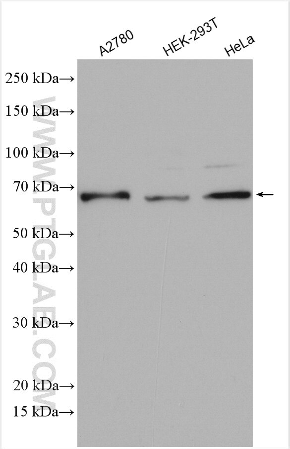 Western Blot (WB) analysis of various lysates using DIS3L2 Polyclonal antibody (28816-1-AP)