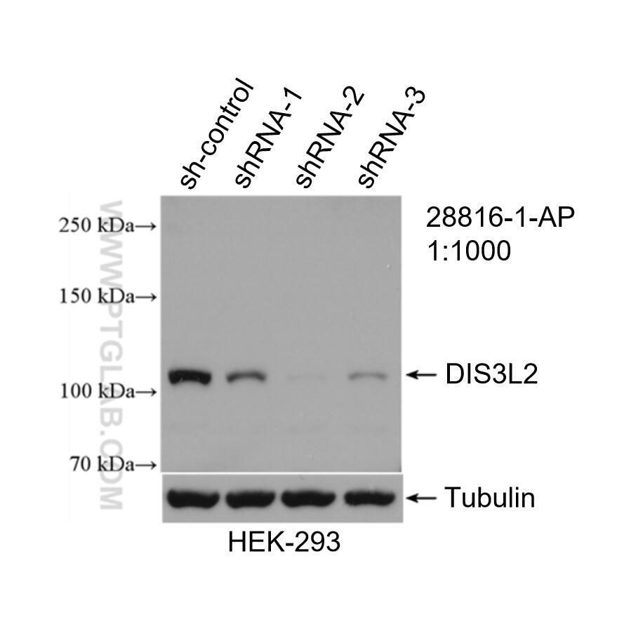 Western Blot (WB) analysis of HEK-293 cells using DIS3L2 Polyclonal antibody (28816-1-AP)