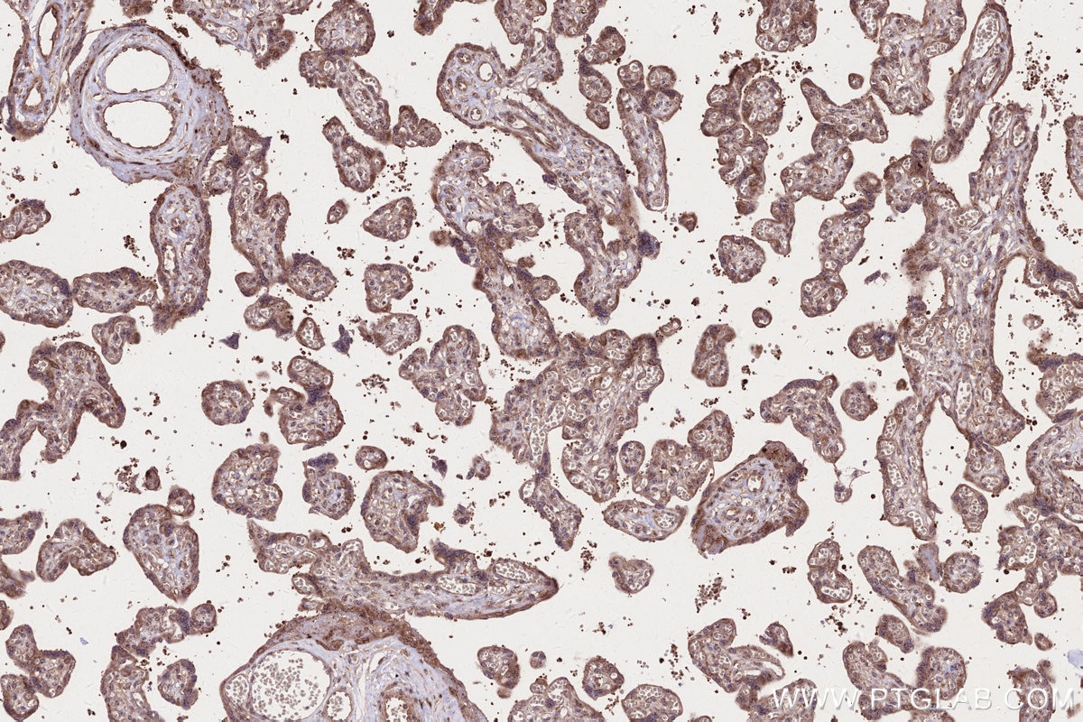 IHC staining of human placenta using 67623-1-Ig Immunohistochemistry (IHC) staining of human placenta tissue using DIS3L2 Monoclonal antibody (67623-1-Ig)