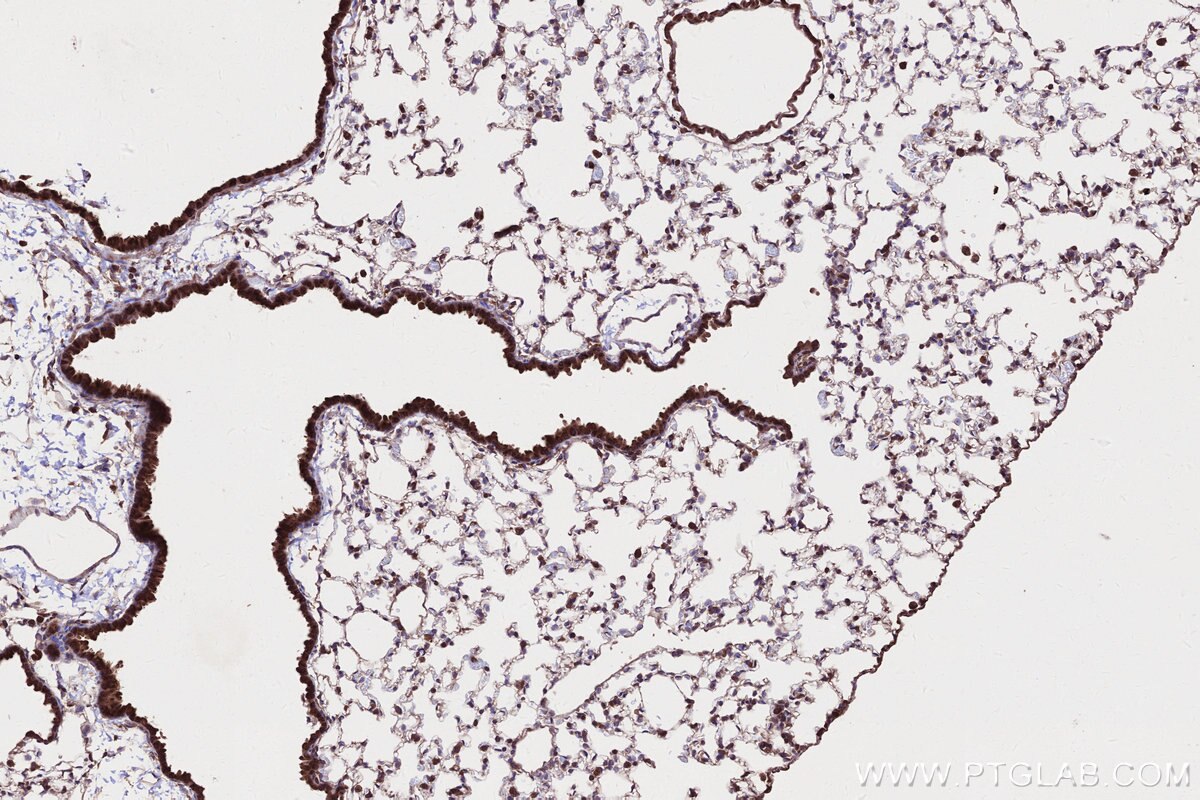 IHC staining of mouse lung using 67623-1-Ig Immunohistochemistry (IHC) staining of mouse lung tissue using DIS3L2 Monoclonal antibody (67623-1-Ig)