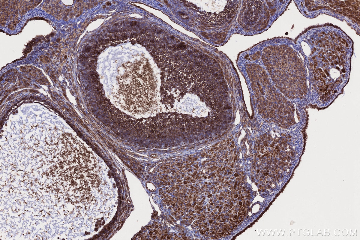 IHC staining of rat ovary using 67623-1-Ig Immunohistochemistry (IHC) staining of rat ovary tissue using DIS3L2 Monoclonal antibody (67623-1-Ig)