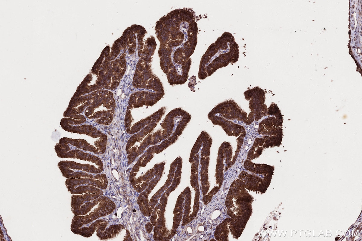 IHC staining of rat ovary using 67623-1-Ig Immunohistochemistry (IHC) staining of rat ovary tissue using DIS3L2 Monoclonal antibody (67623-1-Ig)