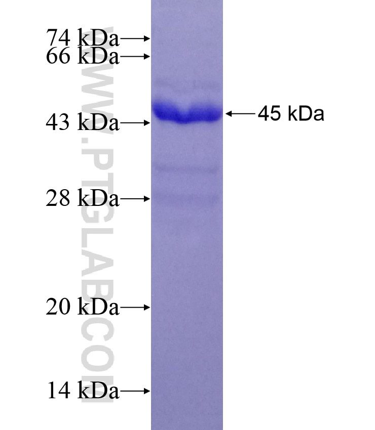 DIS3L2 fusion protein Ag22963 SDS-PAGE