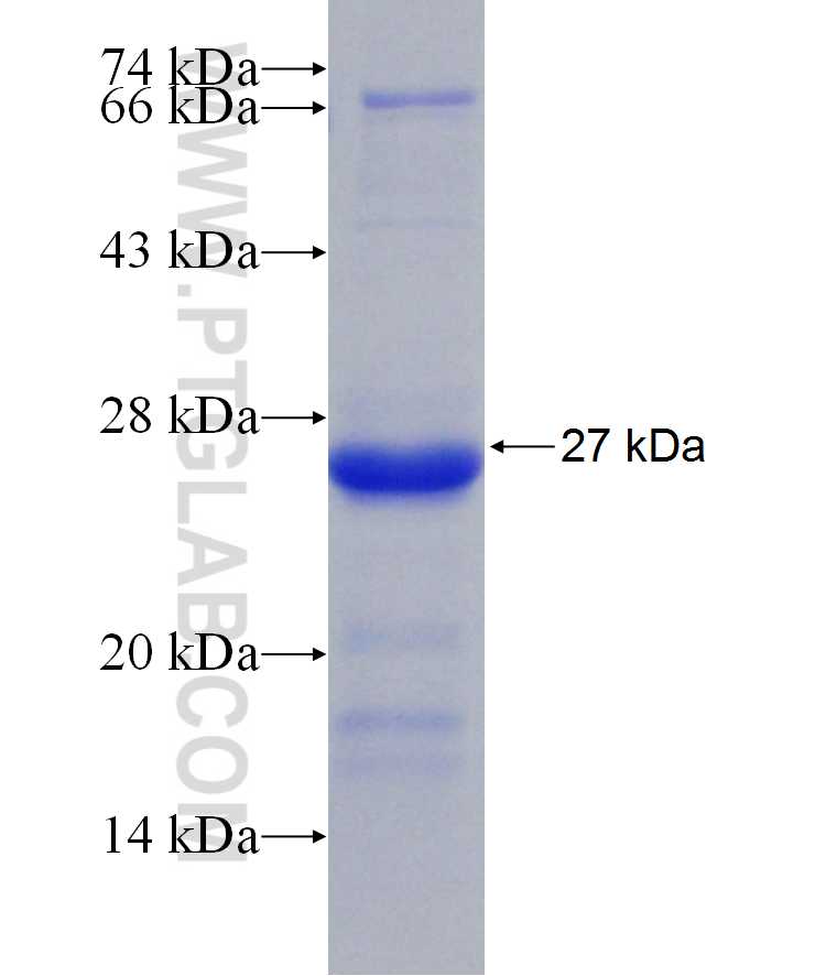 DIS3L2 fusion protein Ag29992 SDS-PAGE