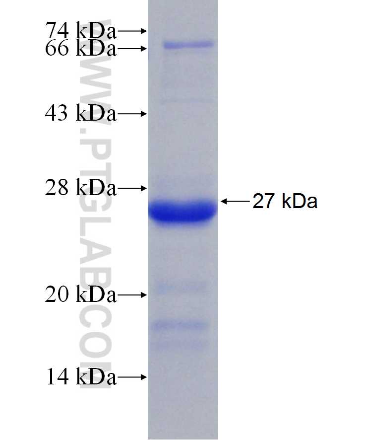 DIS3L2 fusion protein Ag29992 SDS-PAGE