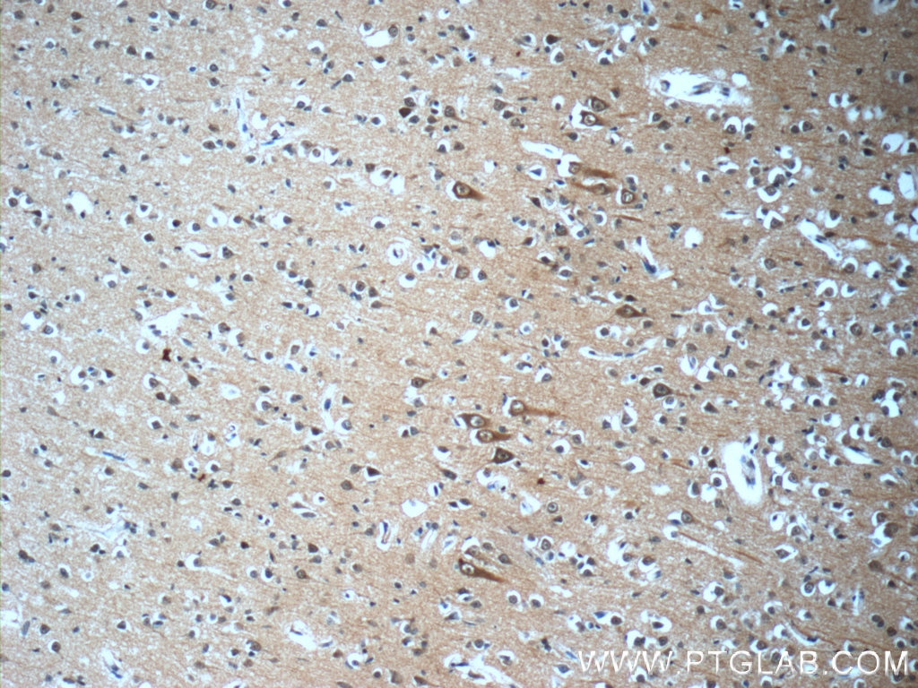 Immunohistochemistry (IHC) staining of human brain tissue using DISC1 Monoclonal antibody (60109-1-Ig)