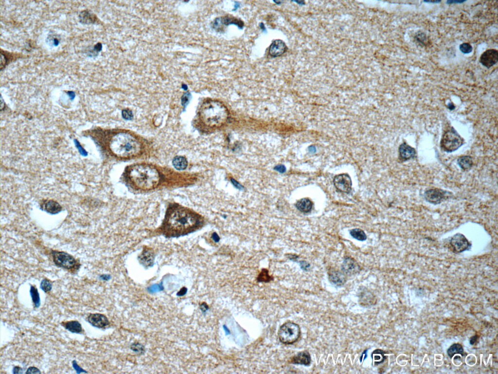 Immunohistochemistry (IHC) staining of human brain tissue using DISC1 Monoclonal antibody (60109-1-Ig)
