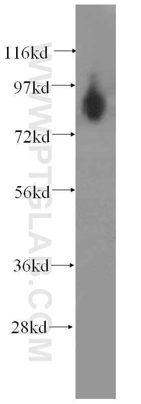 Western Blot (WB) analysis of human kidney tissue using DISC1 Monoclonal antibody (60109-1-Ig)