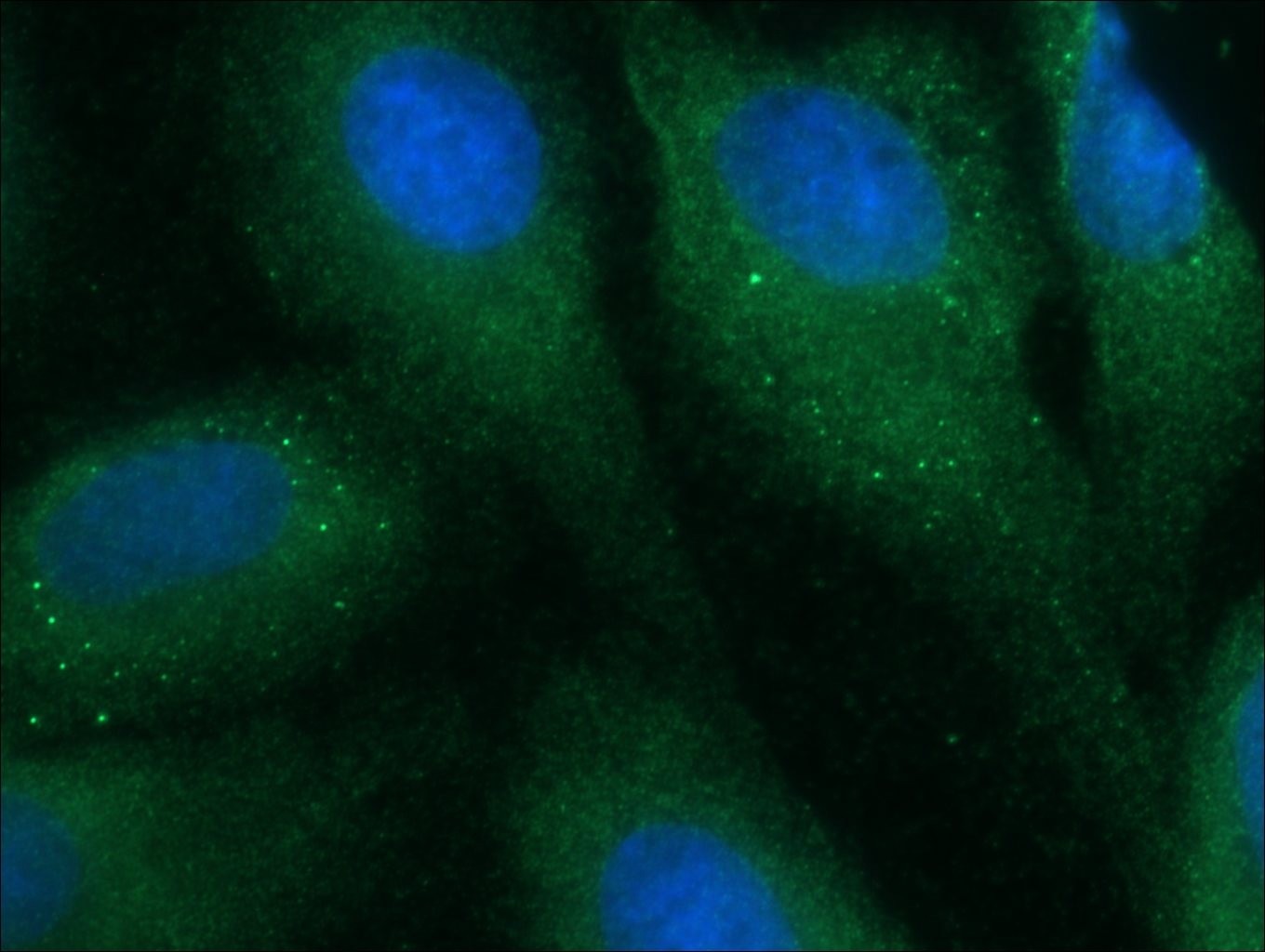 Immunofluorescence (IF) / fluorescent staining of MDCK cells using DISC1-long-specific Polyclonal antibody (15500-1-AP)