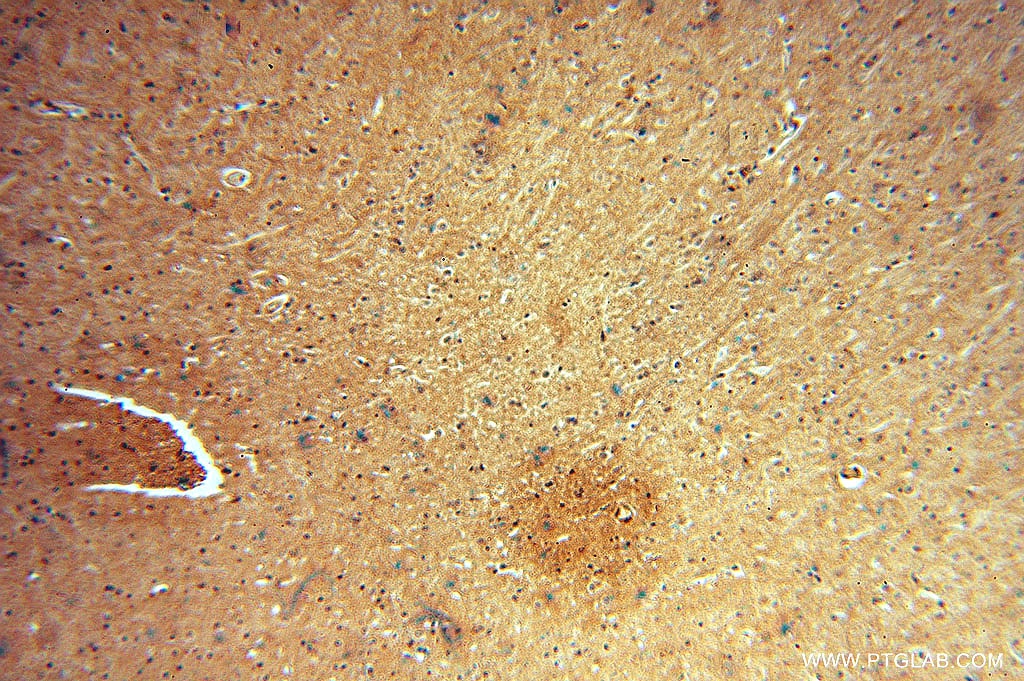 Immunohistochemistry (IHC) staining of human brain tissue using DISC1-long-specific Polyclonal antibody (15500-1-AP)