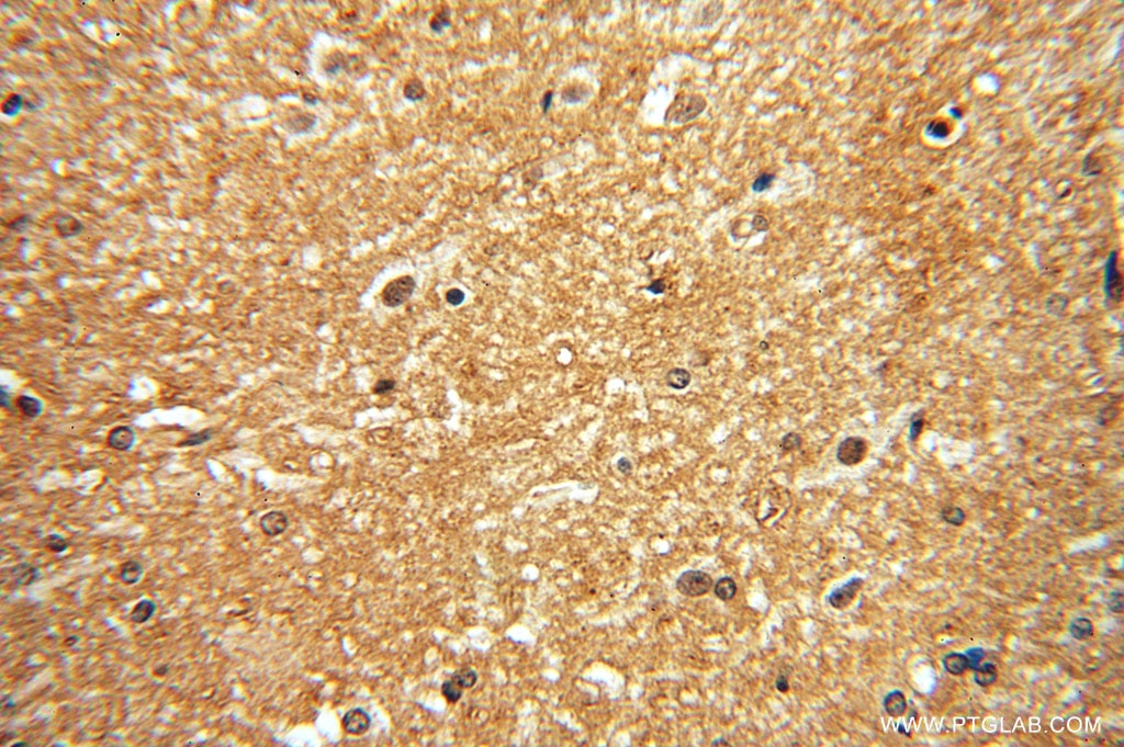 Immunohistochemistry (IHC) staining of human brain tissue using DISC1-long-specific Polyclonal antibody (15500-1-AP)