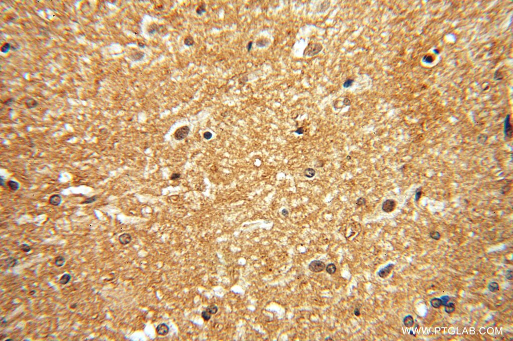 Immunohistochemistry (IHC) staining of human brain tissue using DISC1-long-specific Polyclonal antibody (15500-1-AP)