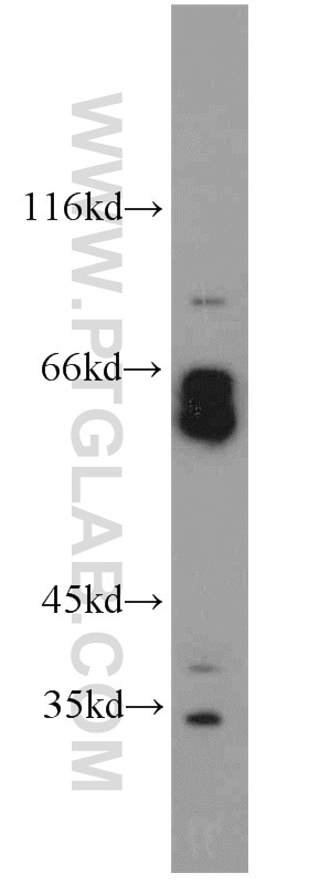 DISC1-long-specific Polyclonal antibody