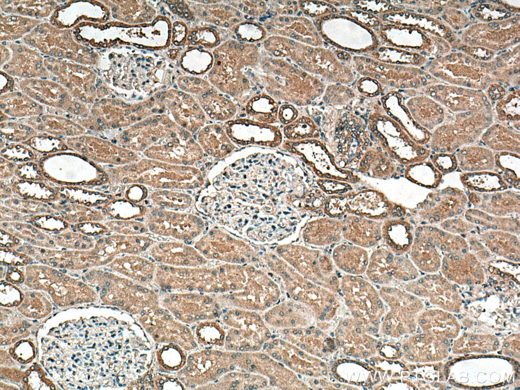 Immunohistochemistry (IHC) staining of human kidney tissue using DISP1 Polyclonal antibody (12041-1-AP)