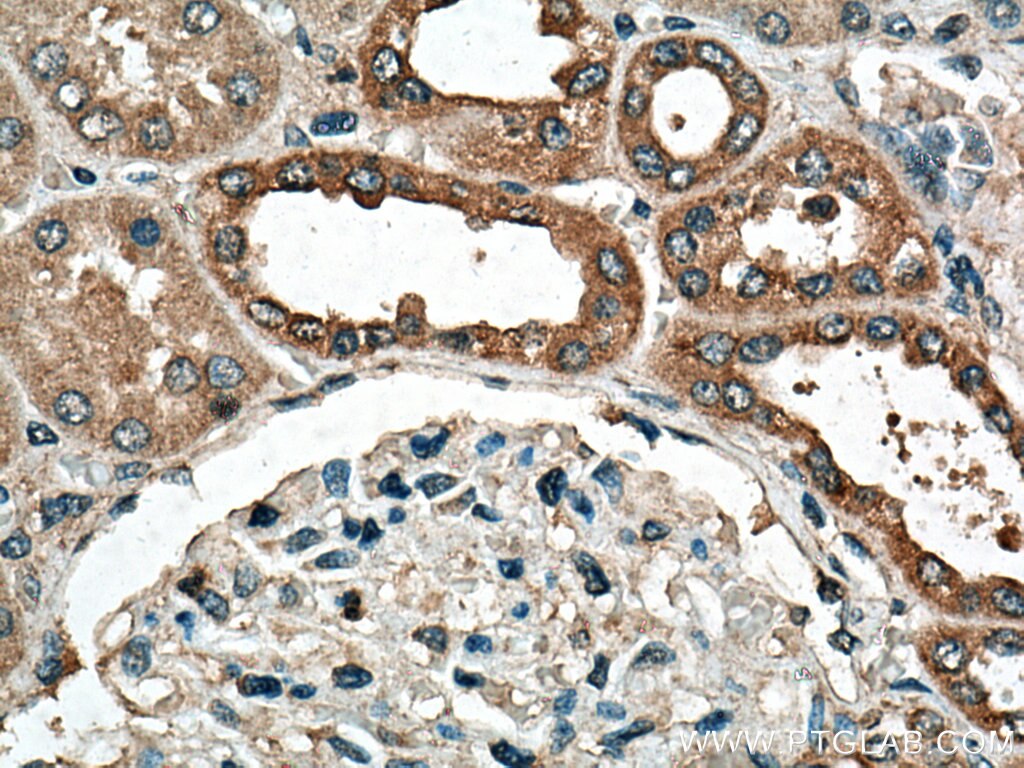 Immunohistochemistry (IHC) staining of human kidney tissue using DISP1 Polyclonal antibody (12041-1-AP)
