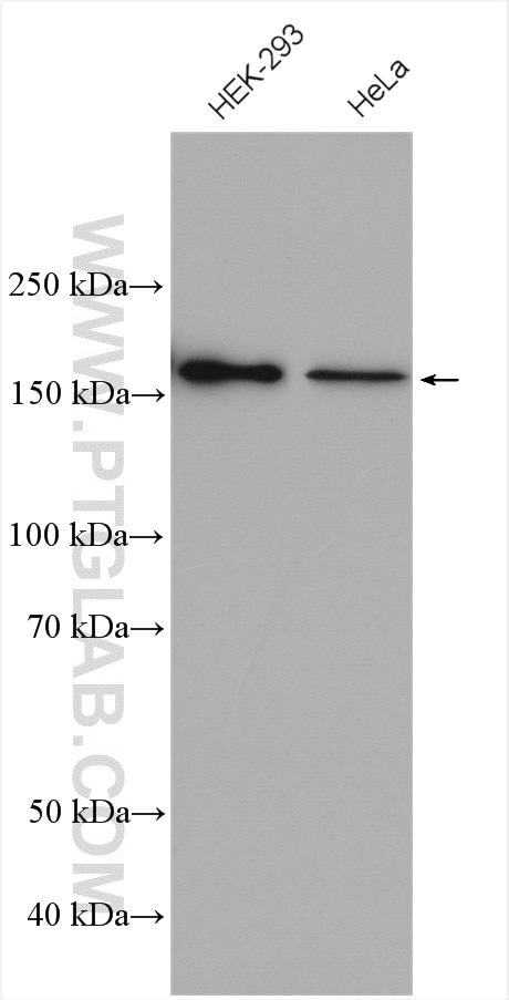 Western Blot (WB) analysis of various lysates using DISP1 Polyclonal antibody (12041-1-AP)