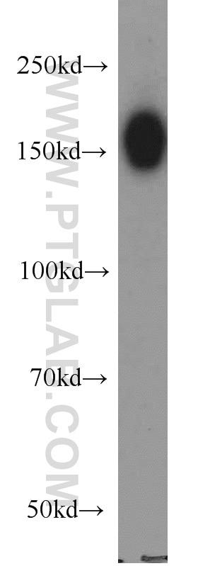 Western Blot (WB) analysis of HeLa cells using DISP1 Polyclonal antibody (12041-1-AP)